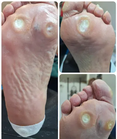 Gabinet Podologiczny Katarzyna Sieroń